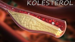 5. Kolesterol | Buliran.com